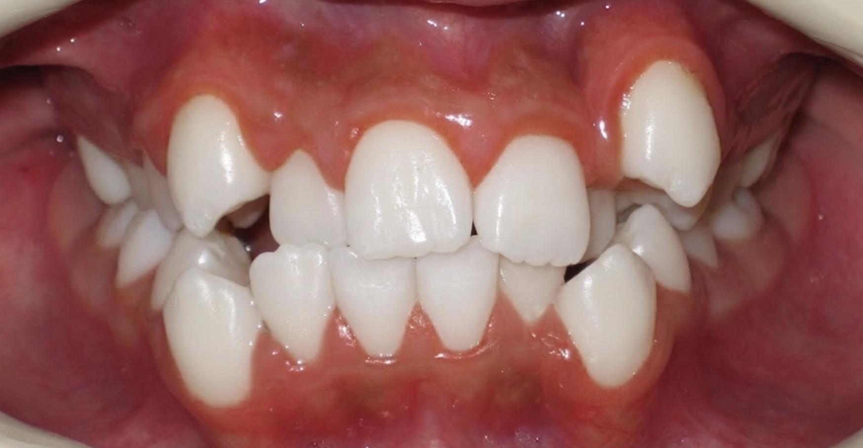Before