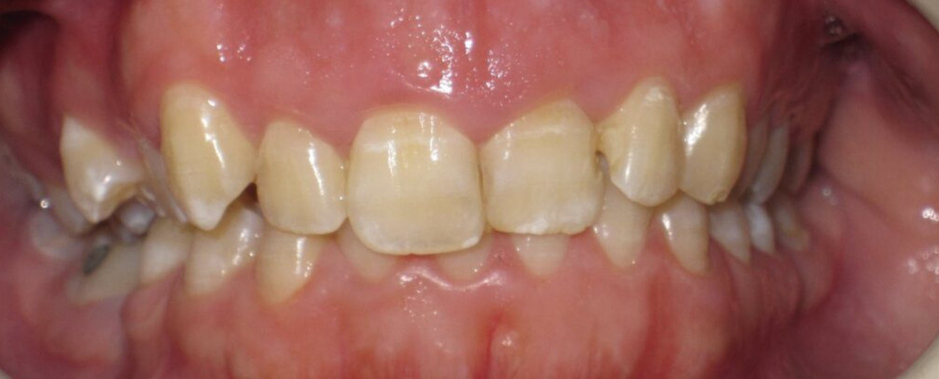 Before