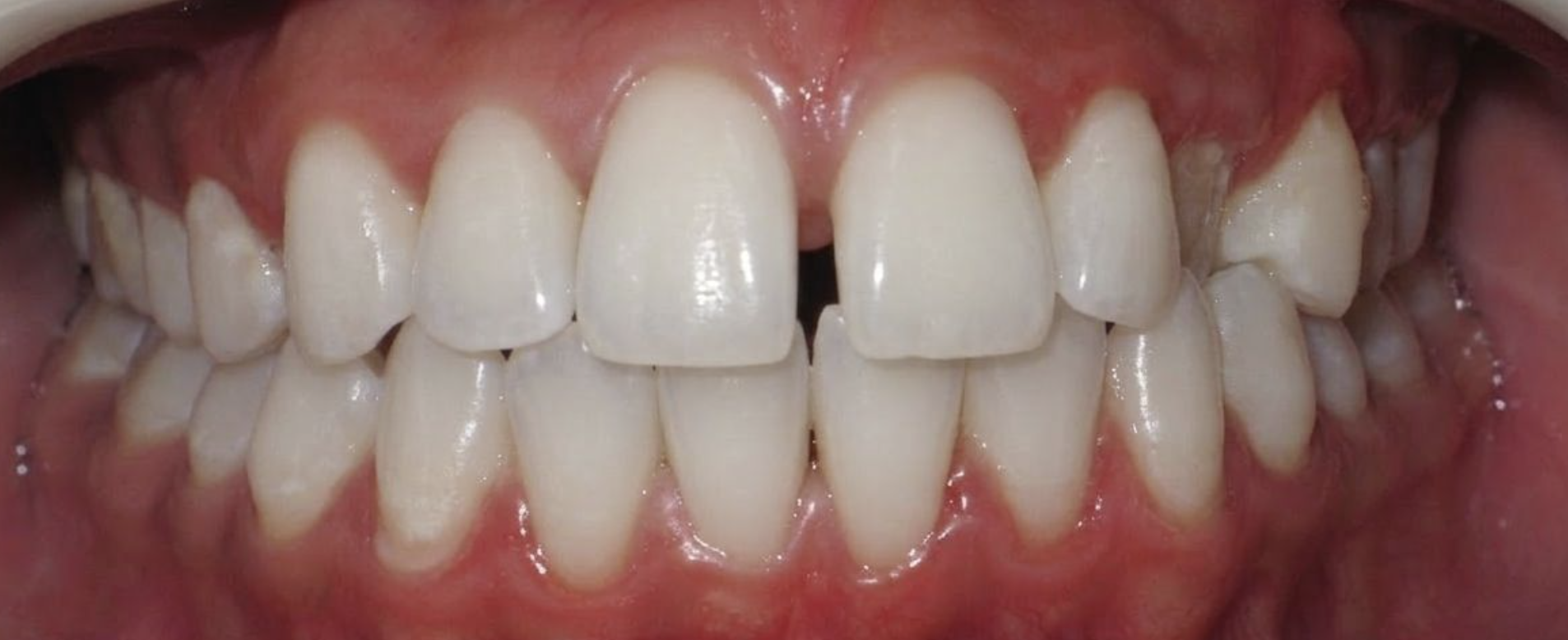 Before