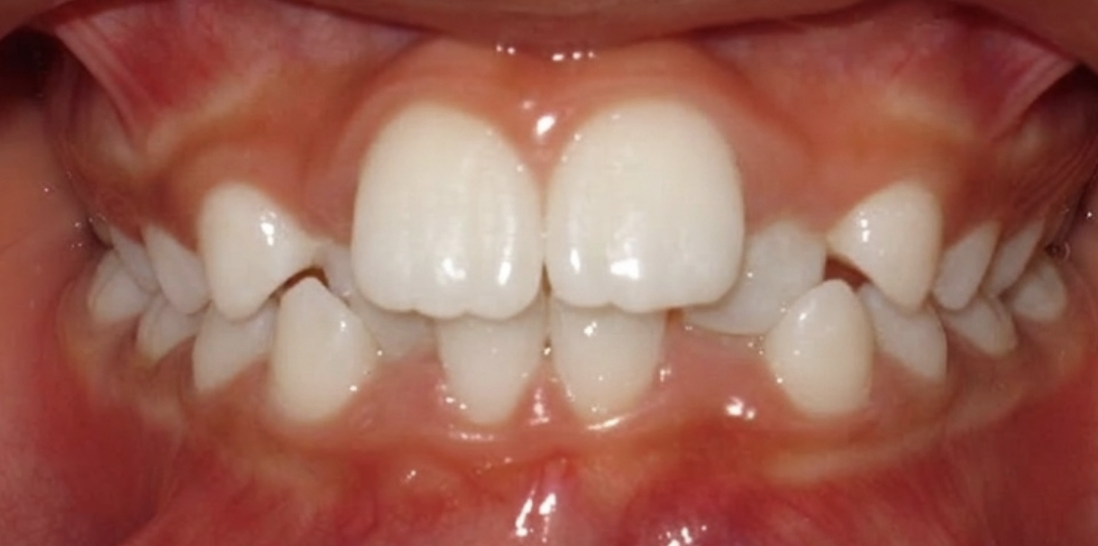 Before